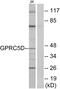 G Protein-Coupled Receptor Class C Group 5 Member D antibody, A30828, Boster Biological Technology, Western Blot image 