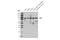 FES Proto-Oncogene, Tyrosine Kinase antibody, 85704S, Cell Signaling Technology, Western Blot image 