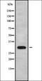 Axin 1 antibody, orb338060, Biorbyt, Western Blot image 