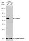 Ubiquitin Specific Peptidase 14 antibody, NBP2-20825, Novus Biologicals, Western Blot image 