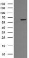 Chaperonin Containing TCP1 Subunit 8 Like 2 antibody, TA505337AM, Origene, Western Blot image 