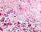 Lysophosphatidic Acid Receptor 5 antibody, NBP1-02354, Novus Biologicals, Immunohistochemistry paraffin image 