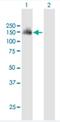 SH3 And PX Domains 2A antibody, H00009644-B01P-50ug, Novus Biologicals, Western Blot image 