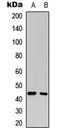 Mitogen-Activated Protein Kinase Kinase 1 antibody, LS-C358805, Lifespan Biosciences, Western Blot image 