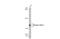 Integrin Subunit Alpha 3 antibody, GTX133642, GeneTex, Western Blot image 