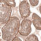 MTM1 antibody, HPA010008, Atlas Antibodies, Immunohistochemistry paraffin image 