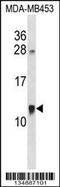 Acyl-CoA Binding Domain Containing 7 antibody, 57-936, ProSci, Western Blot image 