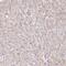 Trichoplein Keratin Filament Binding antibody, NBP1-89572, Novus Biologicals, Immunohistochemistry paraffin image 