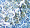 Renal carcinoma antigen NY-REN-26 antibody, LS-C335865, Lifespan Biosciences, Immunohistochemistry paraffin image 