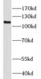 HPS3 Biogenesis Of Lysosomal Organelles Complex 2 Subunit 1 antibody, FNab03999, FineTest, Western Blot image 