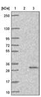 Mediator Complex Subunit 20 antibody, NBP1-84140, Novus Biologicals, Western Blot image 