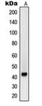 Sarcoglycan Beta antibody, orb214570, Biorbyt, Western Blot image 