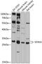 Sideroflexin 3 antibody, 14-351, ProSci, Western Blot image 