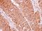 Eukaryotic Translation Initiation Factor 2 Subunit Beta antibody, LS-C155267, Lifespan Biosciences, Immunohistochemistry paraffin image 