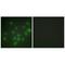 Zinc Finger Protein 875 antibody, A11100, Boster Biological Technology, Immunohistochemistry frozen image 