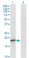 Synuclein Alpha antibody, LS-C198233, Lifespan Biosciences, Western Blot image 