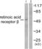 Retinoic Acid Receptor Beta antibody, LS-C827150, Lifespan Biosciences, Western Blot image 