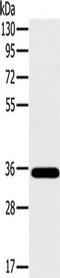 OTU Deubiquitinase, Ubiquitin Aldehyde Binding 1 antibody, TA350256, Origene, Western Blot image 