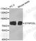 Synaptopodin 2 Like antibody, A3507, ABclonal Technology, Western Blot image 