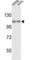 Heat Shock Protein Family H (Hsp110) Member 1 antibody, abx031752, Abbexa, Western Blot image 