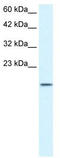 Zinc Finger Protein 7 antibody, TA334004, Origene, Western Blot image 