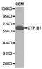 Cytochrome P450 Family 1 Subfamily B Member 1 antibody, LS-C192746, Lifespan Biosciences, Western Blot image 