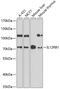 Interleukin 12 Receptor Subunit Beta 1 antibody, 18-365, ProSci, Western Blot image 