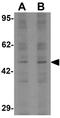 LEM Domain Containing 2 antibody, GTX31857, GeneTex, Western Blot image 