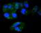 Radixin antibody, NBP2-67584, Novus Biologicals, Immunocytochemistry image 