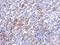 Galectin 3 antibody, GTX125897, GeneTex, Immunohistochemistry paraffin image 