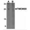 Transmembrane Protein 88 antibody, MBS151139, MyBioSource, Western Blot image 