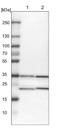 RING finger protein 114 antibody, NBP1-87204, Novus Biologicals, Western Blot image 