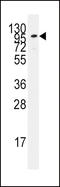 Adenylate Cyclase 2 antibody, LS-C98624, Lifespan Biosciences, Western Blot image 