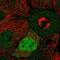 Cyclin D2 antibody, NBP2-58783, Novus Biologicals, Immunocytochemistry image 