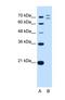 Ring Finger Protein 168 antibody, NBP1-55075, Novus Biologicals, Western Blot image 