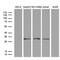 Proteasome 26S Subunit, Non-ATPase 9 antibody, M06113, Boster Biological Technology, Western Blot image 
