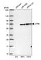 U3 small nucleolar RNA-associated protein 6 homolog antibody, PA5-55272, Invitrogen Antibodies, Western Blot image 