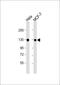 GTSE1 antibody, 64-164, ProSci, Western Blot image 