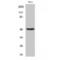 Heterogeneous Nuclear Ribonucleoprotein H1 antibody, LS-C383987, Lifespan Biosciences, Western Blot image 