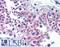 Glutamate Metabotropic Receptor 6 antibody, LS-C141521, Lifespan Biosciences, Immunohistochemistry paraffin image 
