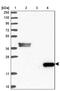 Complement C8 Gamma Chain antibody, PA5-61200, Invitrogen Antibodies, Western Blot image 