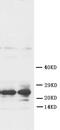 Fibroblast Growth Factor 8 antibody, PA5-79259, Invitrogen Antibodies, Western Blot image 