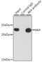 Adenylate kinase isoenzyme 4, mitochondrial antibody, GTX65835, GeneTex, Immunoprecipitation image 