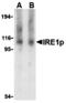 Serine/threonine-protein kinase/endoribonuclease IRE1 antibody, MBS150204, MyBioSource, Western Blot image 