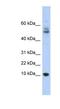 Myotrophin antibody, NBP1-54959, Novus Biologicals, Western Blot image 