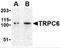 Transient Receptor Potential Cation Channel Subfamily C Member 6 antibody, 3899, ProSci, Western Blot image 