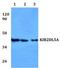 Killer Cell Immunoglobulin Like Receptor, Two Ig Domains And Long Cytoplasmic Tail 5A antibody, GTX66782, GeneTex, Western Blot image 