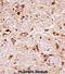 Fibroblast Growth Factor Receptor 3 antibody, abx028350, Abbexa, Immunohistochemistry frozen image 