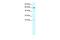 SPT3 Homolog, SAGA And STAGA Complex Component antibody, PA5-40315, Invitrogen Antibodies, Western Blot image 