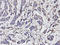 Transforming Growth Factor Beta Induced antibody, LS-C332168, Lifespan Biosciences, Immunohistochemistry frozen image 